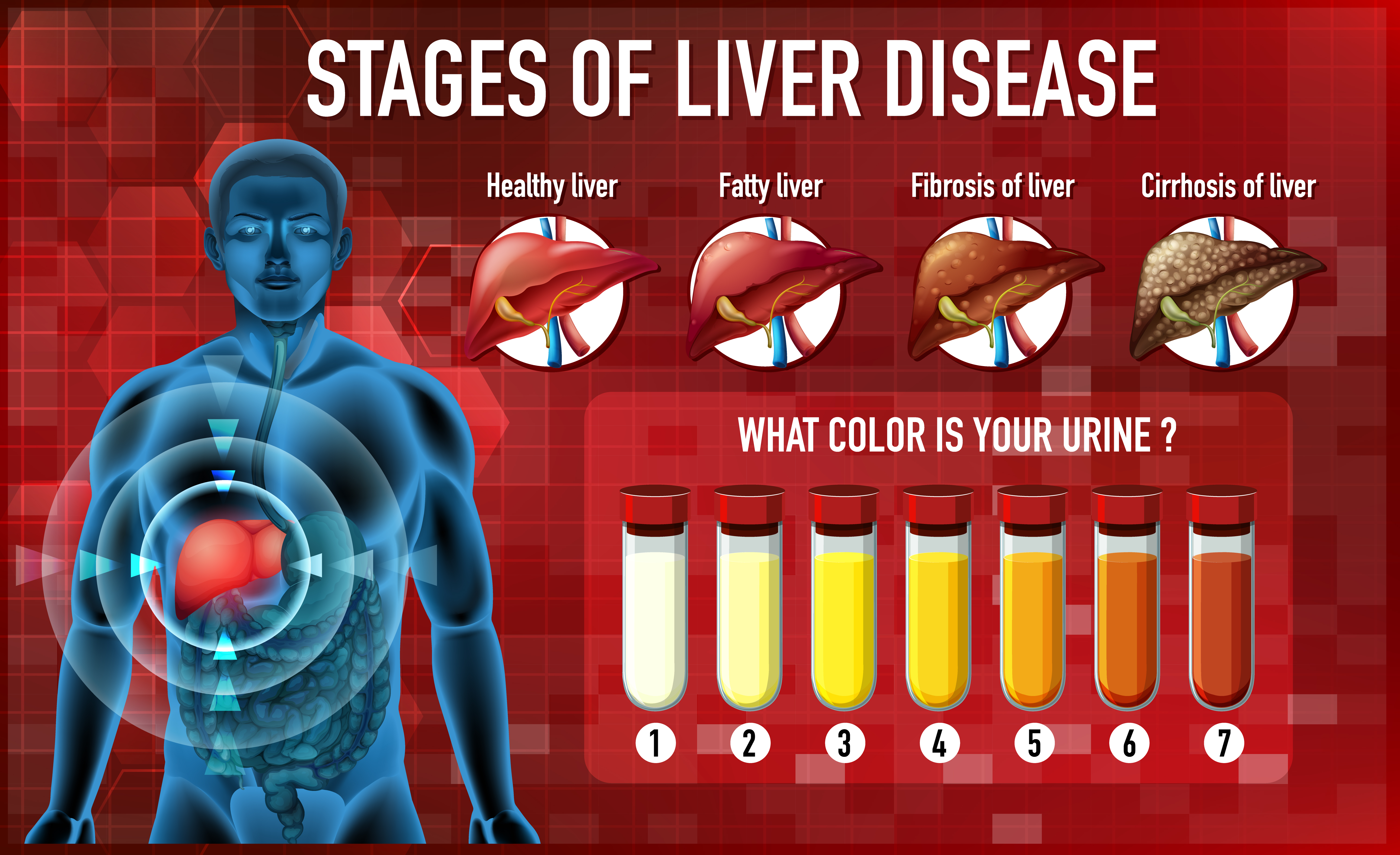 stages of liver disease