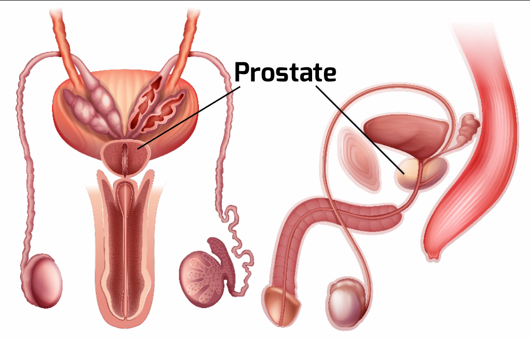 prostate